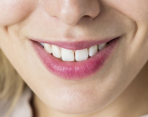 Blanqueamiento dental