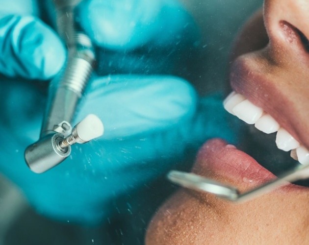 Reconstrucción diente